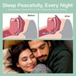 Anti-Snoring Mouthpiece